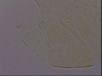 Echiniscus porabrus image