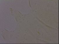 Echiniscus porabrus image