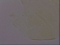 Echiniscus porabrus image