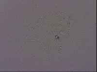 Echiniscus quadrispinosus brachyspinosus image