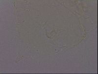 Echiniscus quadrispinosus brachyspinosus image