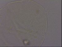Echiniscus quadrispinosus brachyspinosus image