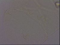 Echiniscus quadrispinosus brachyspinosus image