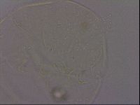 Echiniscus quadrispinosus brachyspinosus image
