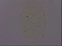 Echiniscus quadrispinosus brachyspinosus image