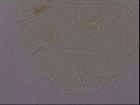 Echiniscus quadrispinosus brachyspinosus image