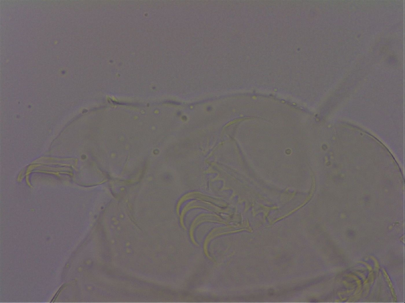 Echiniscus quadrispinosus brachyspinosus image