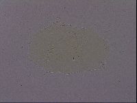 Echiniscus quadrispinosus brachyspinosus image