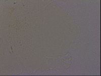 Echiniscus quadrispinosus brachyspinosus image