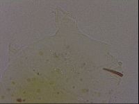 Echiniscus quadrispinosus brachyspinosus image