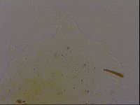 Echiniscus quadrispinosus brachyspinosus image