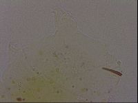Echiniscus quadrispinosus brachyspinosus image