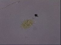 Echiniscus quadrispinosus image