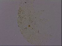 Echiniscus quadrispinosus image