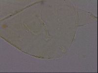Echiniscus quadrispinosus image