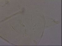 Echiniscus quadrispinosus image