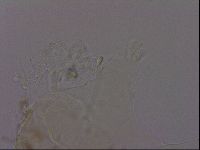 Echiniscus quadrispinosus image