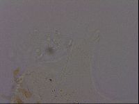 Echiniscus quadrispinosus image