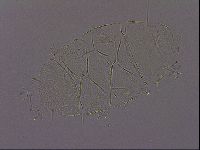 Echiniscus quadrispinosus image