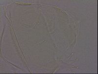 Echiniscus quadrispinosus image