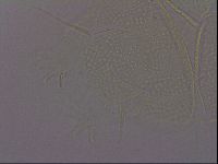 Echiniscus quadrispinosus image
