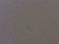Echiniscus quadrispinosus image