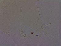 Echiniscus quadrispinosus image