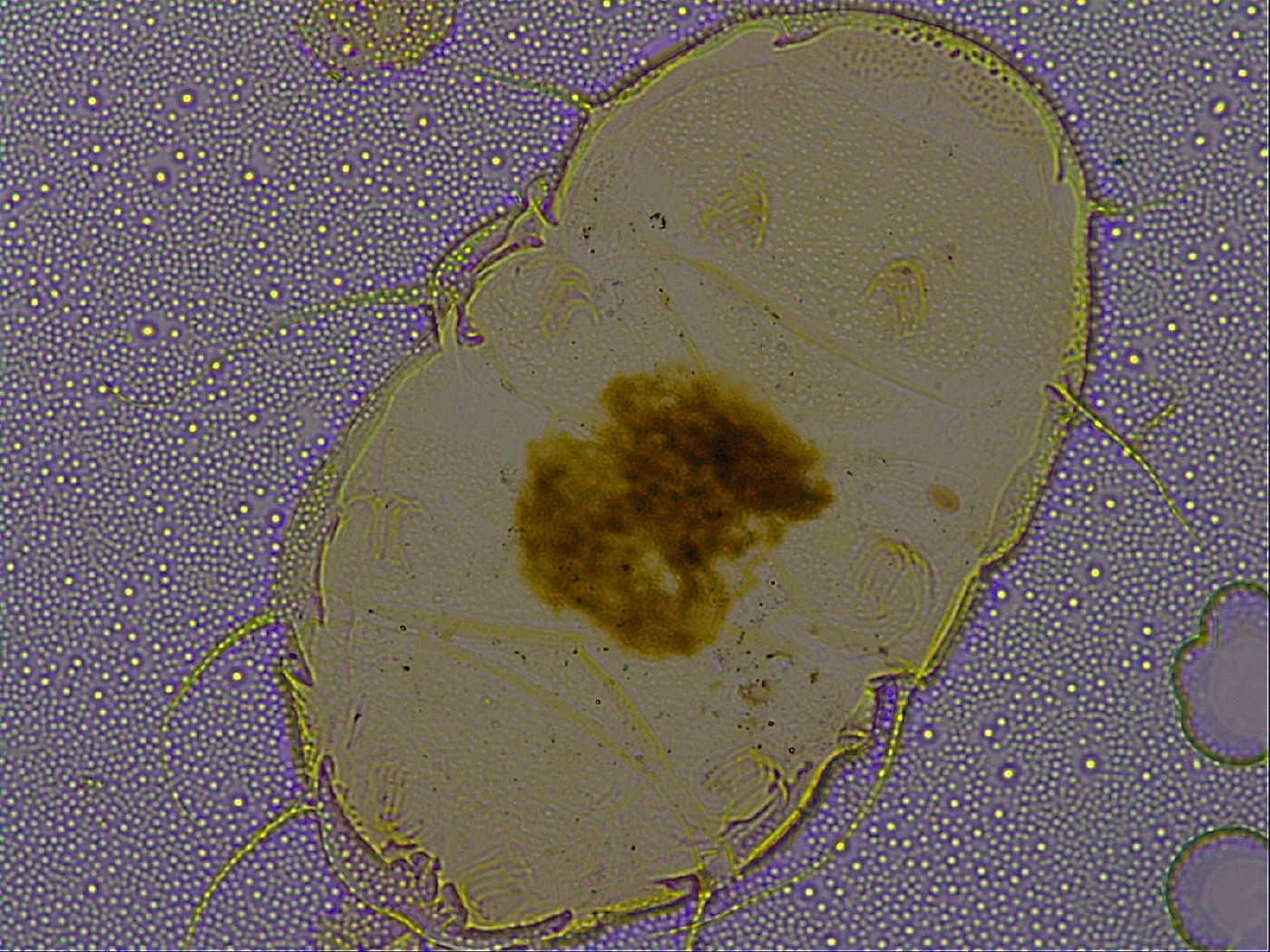 Echiniscus quadrispinosus quadrispinosus image