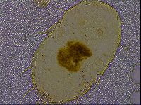 Echiniscus quadrispinosus quadrispinosus image