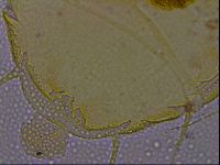 Echiniscus quadrispinosus quadrispinosus image