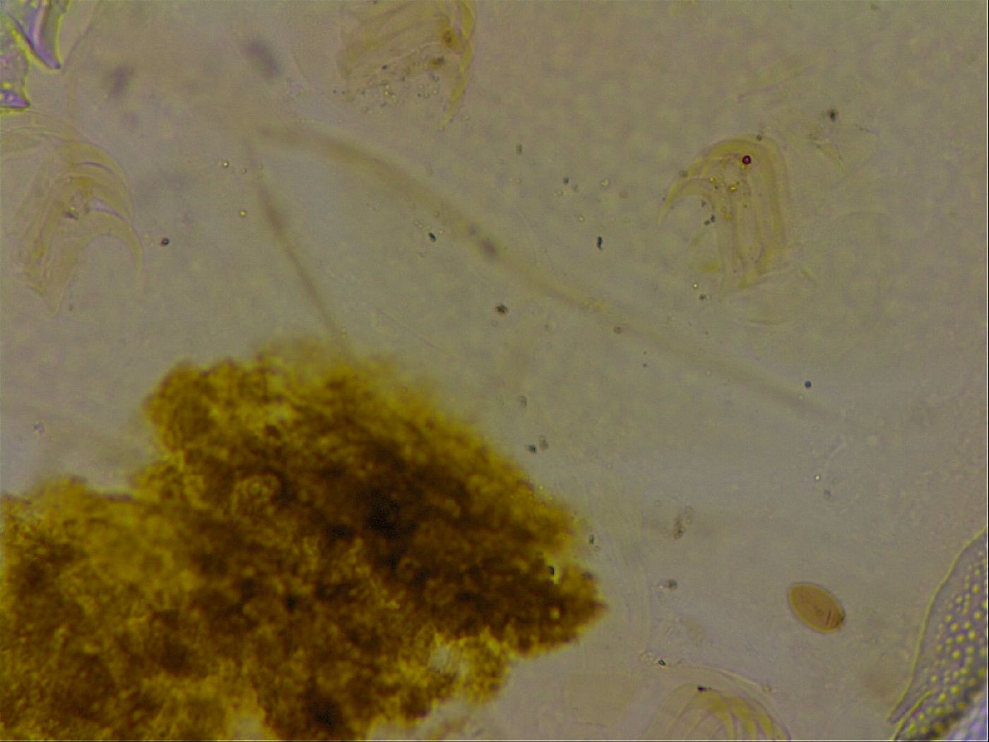 Echiniscus quadrispinosus quadrispinosus image