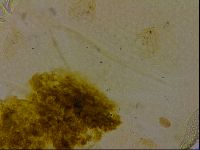 Echiniscus quadrispinosus quadrispinosus image