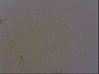 Echiniscus quadrispinosus image