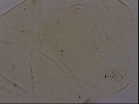 Echiniscus quadrispinosus image