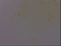 Echiniscus quadrispinosus image