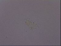 Echiniscus quadrispinosus image