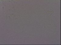 Echiniscus quadrispinosus image