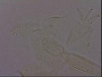 Echiniscus quadrispinosus image