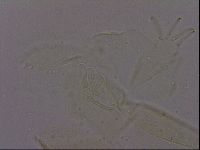 Echiniscus quadrispinosus image