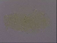 Echiniscus quadrispinosus image
