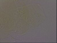 Echiniscus quadrispinosus image
