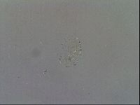 Echiniscus quadrispinosus image