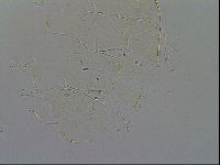 Echiniscus quadrispinosus image