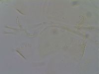 Echiniscus quadrispinosus image
