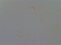 Echiniscus quadrispinosus image