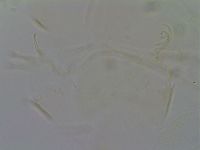 Echiniscus quadrispinosus image