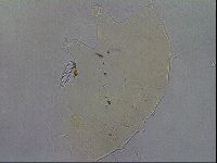 Echiniscus quadrispinosus image