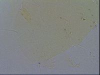Echiniscus quadrispinosus image