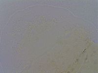 Echiniscus quadrispinosus image