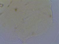 Echiniscus quadrispinosus image